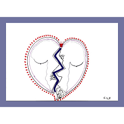 Coeur traumas